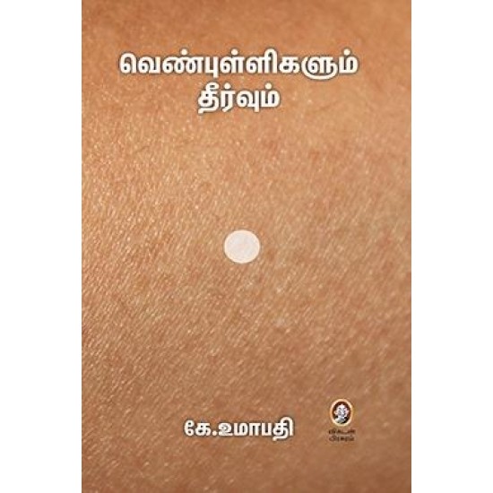 வெண்புள்ளிகளும் தீர்வும் வெண்புள்ளிகளும் தீர்வும்